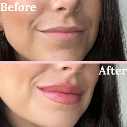 Maxi-Lip™ Lip Plumper